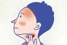 她常盗汗竟是这种瘤作怪丨每日话题图片