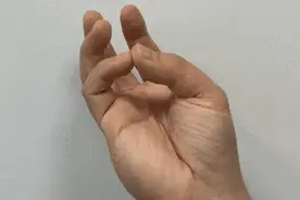 注意！有这种病的人越来越多，不重视或致残图片