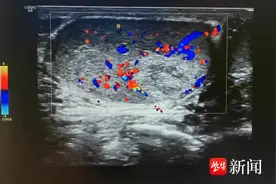 世界男性健康日|突然疼痛常为急症！男性出现这个问题切勿讳疾忌医图片