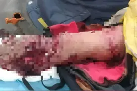 老虎扑咬73岁老人撞到铁栅栏，家属：老虎咬人后欲闯我家图片