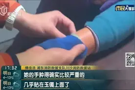 患者手腕骨折后遇大麻烦!医生束手无策…图片