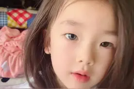 7岁女孩天生异瞳，眼睛一蓝一棕！妈妈：不影响视力图片