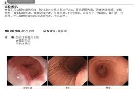 老人反复胸痛，竟是胃“跑”进了胸腔？图片