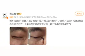 新闻多一度丨郭艾伦眼睛受伤引关注 运动时我们该如何保护双眼？图片