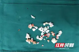 卓越医疗丨告别髋关节疼痛 永州市中心医院“钥匙孔”技术精准清除关节内“小石子”图片