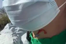 闪电律解｜女子河边散步遭鱼钩“封喉” 钓鱼大爷：去告我吧 律师：赔偿争议可提起诉讼图片