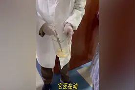 女子肛门处刺痒难忍 医院驱虫排出长达10米寄生虫图片