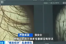 曝光了！“没长出来”“秃的”！有人欠下万元“植发贷”……图片