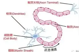 体检发现脑白质脱髓鞘 别慌图片