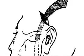 男子呼吸困难，命悬一线，根源竟在“小小牙病”图片