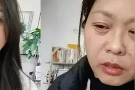 短短20天，女子“断崖式衰老”！医生：无法逆转！图片