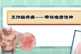 科普视频｜王炸级疼痛——带状疱疹性神经痛图片