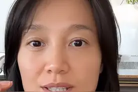 知名女主持自曝严重心悸，竟是因为鸡蛋过敏图片
