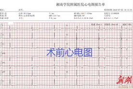 心脏起搏哪种好？只选对的，不选贵的图片