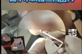 隔着屏幕都感到痛!沪一男子垂钓,上钩的竟是自己图片