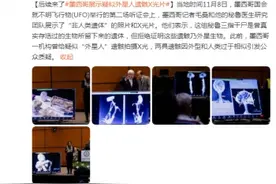 后续来了 墨西哥展示疑似“外星人”遗骸X光片图片