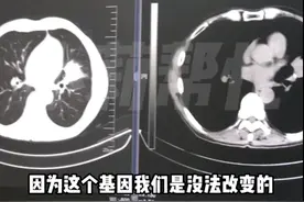 一家9人患癌8人离世，医生：几代人都有这个坏习惯，必须改图片