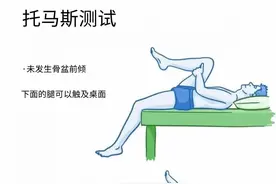 别再焦虑了！你可能根本不是“骨盆前倾”！图片