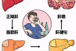 别让脂肪肝悄悄“缠上”你图片