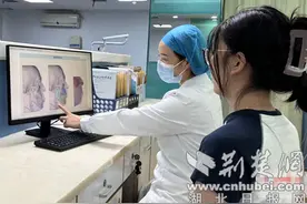 太和医院正畸正颌联合治疗让严重口腔骨性畸形患者重拾微笑图片