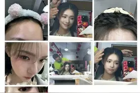 林允“刷酸”冲上热搜：没想到这么猛！医生提醒图片