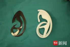 13年坚持爱心助力！江苏省中医院“耳再造公益”已让百余名小耳畸形患儿受益图片