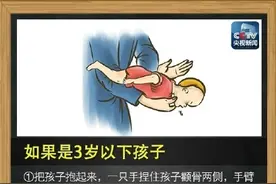 记住这个海姆立克急救法！关键时刻能救命图片