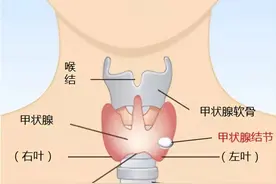 甲状腺结节究竟看哪个科？多学科联合门诊“一站式”解决→图片