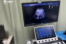 超声诊断设备销售“灰色链条”再调查：现金交易不开票，“洗白”身份售卖图片