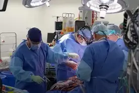 男子靠“机器心脏”存活超100天图片