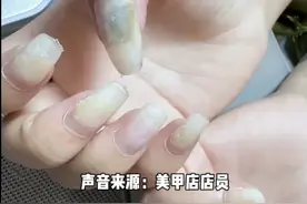 可怕！女子十指空甲发霉，还有人全甲拔除，全因这事惹病上身图片