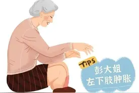 沉默的杀手——下肢深静脉血栓，你知多少？图片