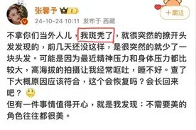 “秃”然！又一女明星自爆“鬼剃头”   专家：斑秃其实是一种免疫紊乱图片