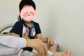 多学科护航，让“玻璃人”不再易碎图片