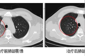 持续高热、头痛、全身酸痛，江苏确诊一例罕见传染病图片