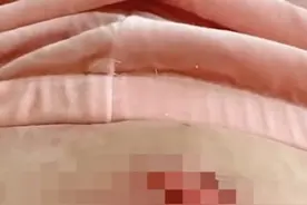 女子一觉醒来，撕掉一大块皮！又是它惹祸，近期尤其要注意……图片