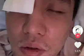眼睛受伤，郭艾伦发声！“缝了40多针！以后可能打不了篮球了”图片