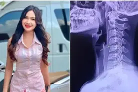 知名女歌手按摩后瘫痪，医治一个月后身亡图片
