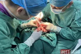 断指再植成功！这家创伤外科团队让“大拇指”复活了图片