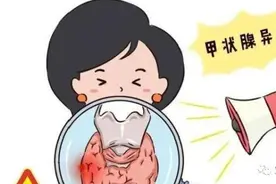 “甲亢”来袭，不可掉以轻“心”图片
