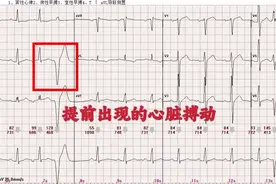心脏“怦怦”乱跳，别不当回事儿！图片