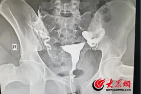 菏泽市创伤医院（菏泽市六院）开展无痛子宫输卵管造影技术图片