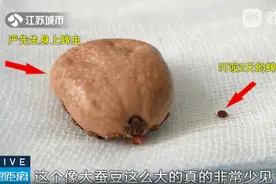 ​“破裂的黑痣”竟然会动！巨无霸蜱虫吸血二十余天！图片
