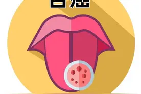 男子口腔溃疡久治不愈，被确诊为舌癌图片