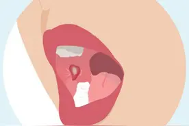 老年人应关注口腔黏膜变化，发现异常及时诊治图片