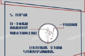 心肺复苏术，每个人都应该掌握！图片