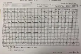 男子酒后突然喉咙痛，竟是心梗？医生提醒……图片
