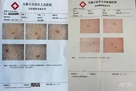 看丹观察丨查监控被拒、家长改口！“幼儿园女童被扎”事件须尽快给个交代！图片
