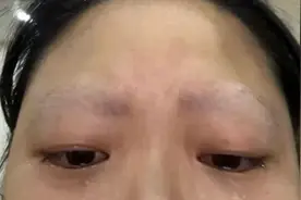 重庆一女子被家养鹦鹉啄光眉毛，当事人回应图片