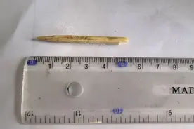 一个急刹，竹签插进2岁男童脸部……图片